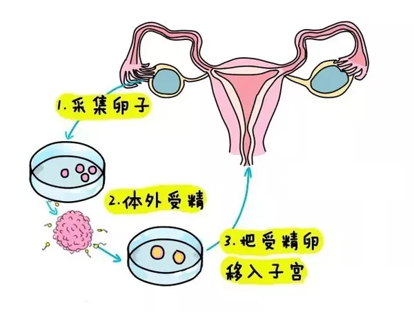 达州捐卵机构公司